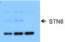 STN8 | Serine/threonine-protein kinase STN8 (chloroplastic)